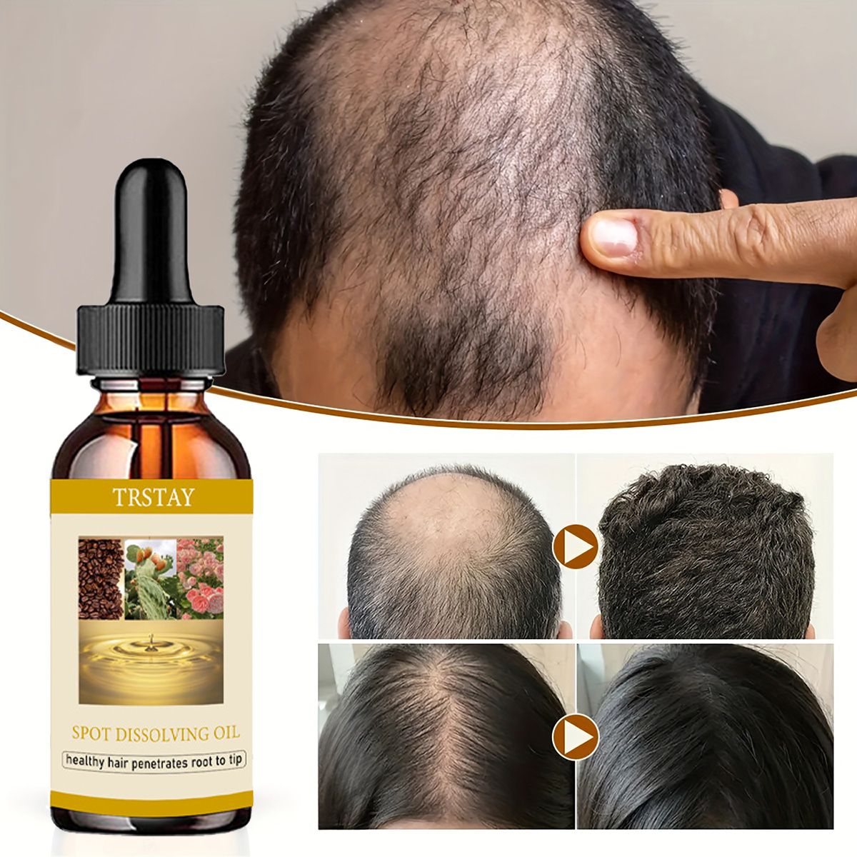 Beard Oil Growth - 50ml óleo de crescimento de barba