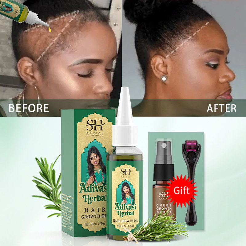 Óleo Ayurvédico para Crescimen - Beard Oil Growth avaliação e preço