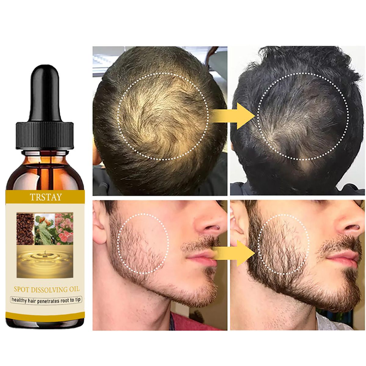 50ml óleo de crescimento de ba - Beard Oil Growth avaliação e preço