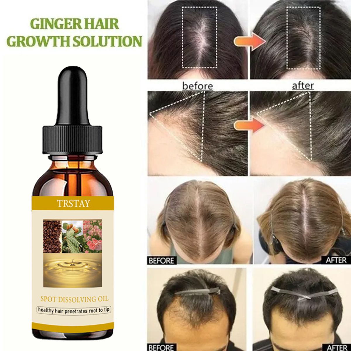 50ml óleo de crescimento de ba - Beard Oil Growth avaliação e preço